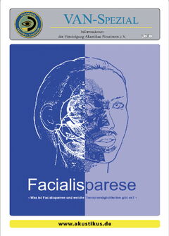 Facialisparese